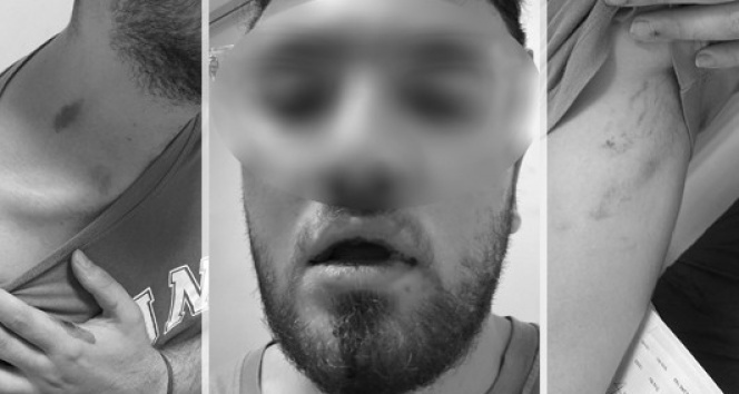 Tıp Fakültesi öğrencilerine emlakçıdan darp ve tehdit iddiası