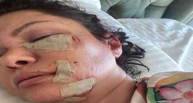 Ünlü şarkıcı Tuğba Altıntop köpek saldırısına uğradı