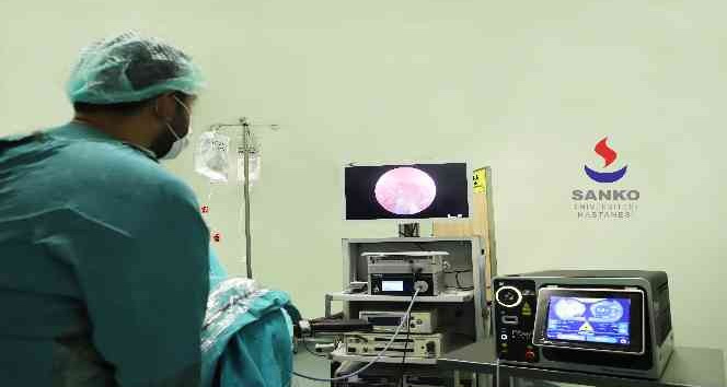 Böbrek taşı tedavisinde thulium fiber teknolojisi