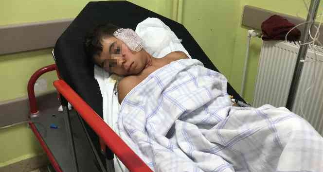 Edirne’de köpekler çocuğa dehşeti yaşattı: O anlar kamerada