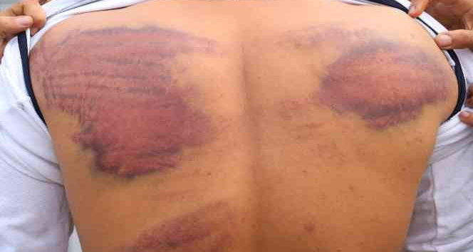 Yunan güvenlik güçlerinden düzensiz göçmenlere işkence