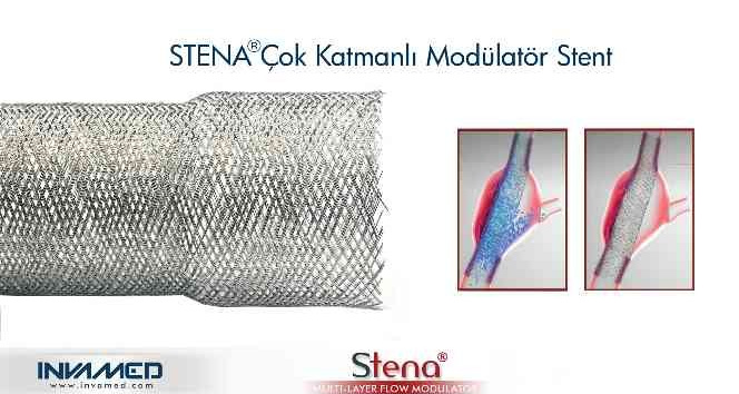 Aort anevrizmasına STENA stent tedavisi