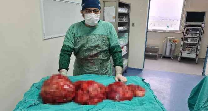 Kilo aldığını sanıyordu, karnından çıkanlar şoke etti