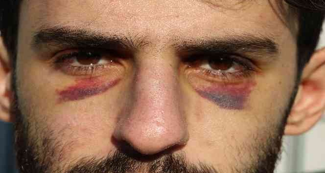 (Düzeltme) Yunanistan bir kez daha ölüme itti: Soydular, dövdüler, çıplak halde geri gönderdiler