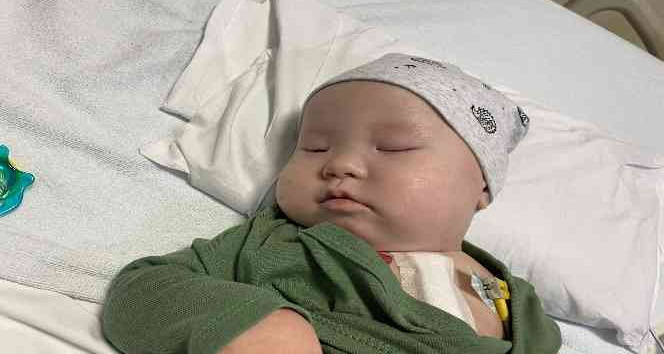 Türk doktorlardan Kırgız Aman bebeğe hayati müdahaleler: Önce karaciğer nakli sonra kalp ameliyatı