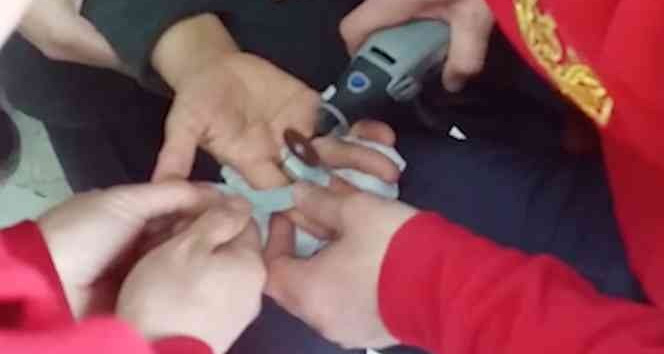 Parmağına sıkışan yüzüğü itfaiye çıkardı