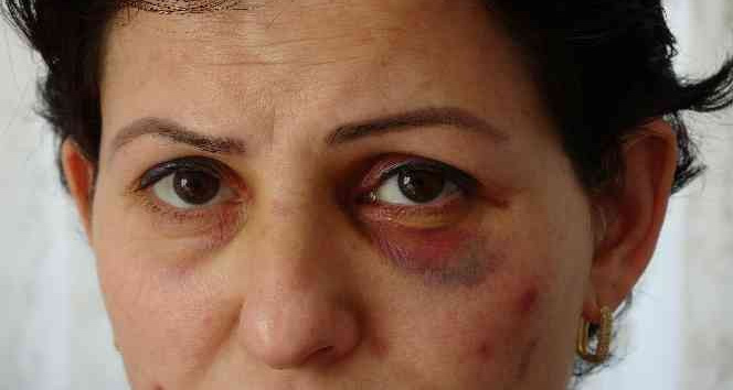 Arabayla takip edilip sokak ortasında darbedilen anne ve kızı için koruma kararı çıktı