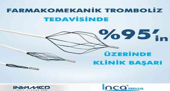Trellis Tromboliz Sistemi ile DVT tedavisinde yüzde 95’in üzerinde klinik başarı sağlanıyor