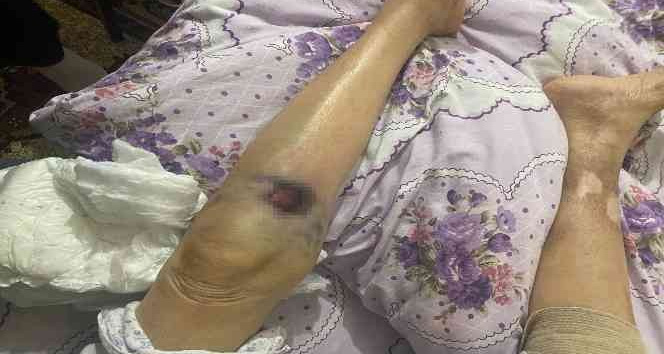 Ankara’da bakıcı dehşeti: 91 yaşındaki yaşlı kadın hastanede ölüm kalım savaşı veriyor