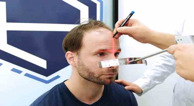 D&uuml;nyanın en iyi sa&ccedil; ekim merkezleri İstanbul&rsquo;da
