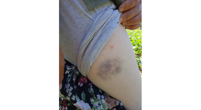 Akrabaların hayvan g&uuml;bresi d&ouml;kme kavgası cep telefonuna yansıdı
