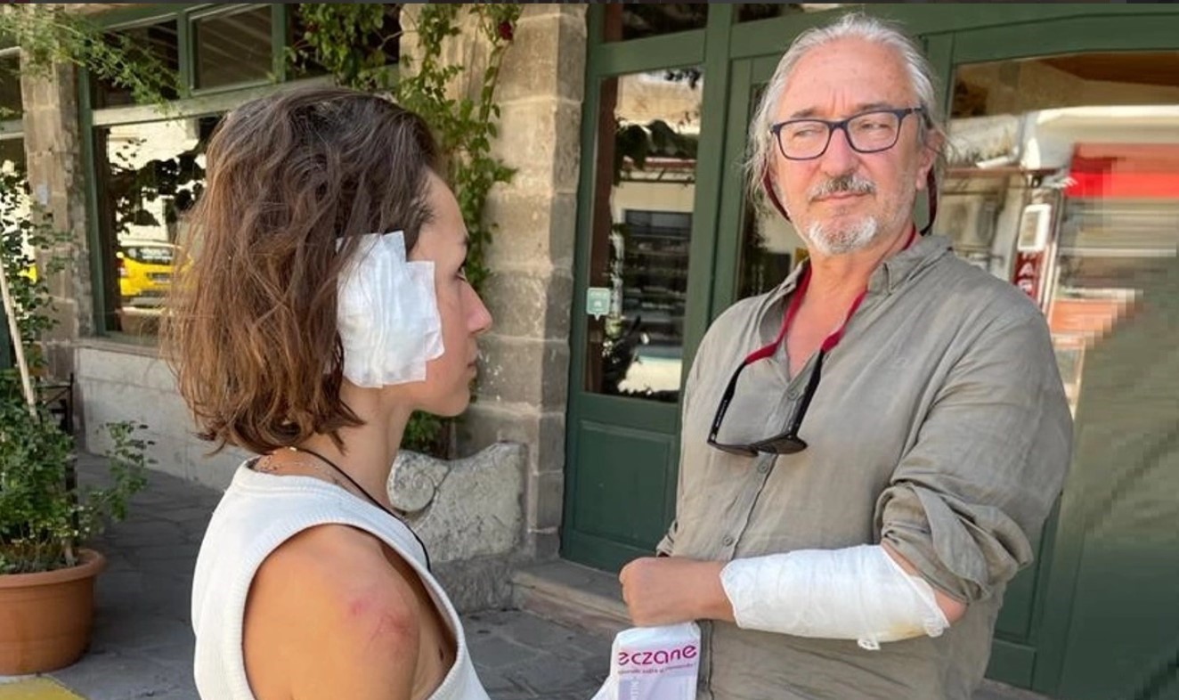 Sokak k&ouml;peği turistlere saldırdı: 2 yaralı
