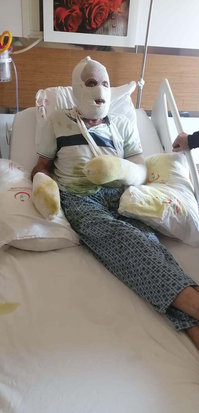 Hayvanlarını kurtarmak isterken yaralandı
