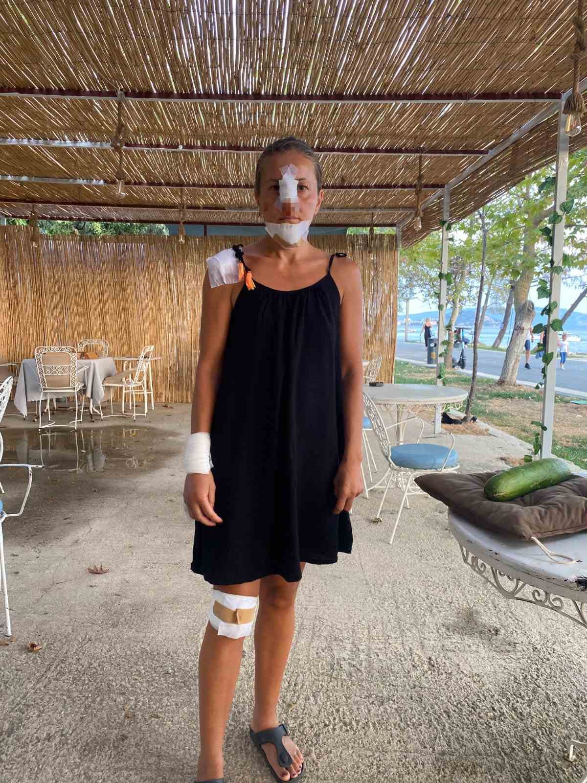 Erdek&rsquo;te k&ouml;peklerinin saldırısına uğrayan kadın ve kızı scooterdan d&uuml;şt&uuml;
