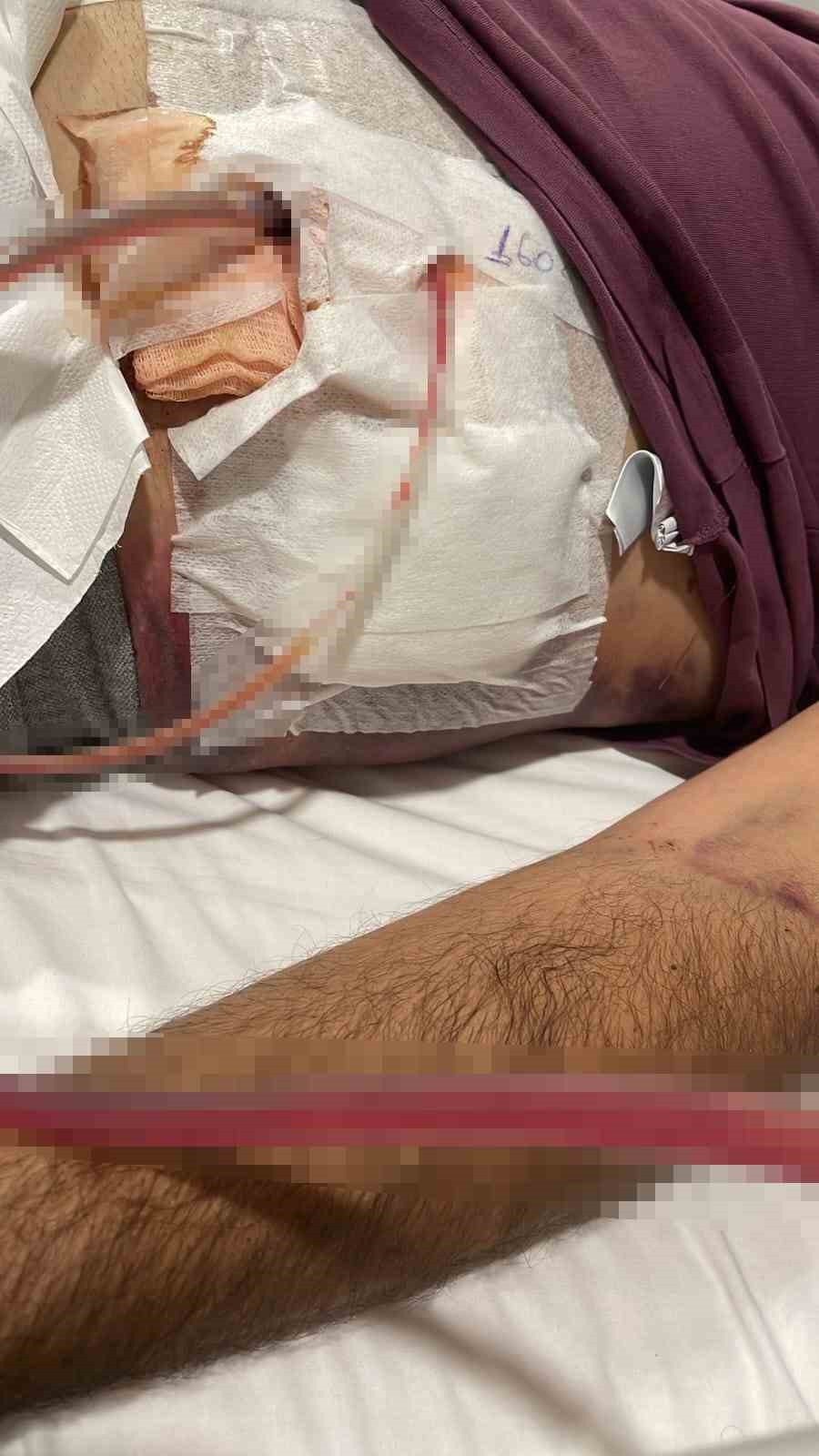 Yoldan ge&ccedil;en kadına laf atanlara tepki g&ouml;sterince karnından bı&ccedil;aklandı
