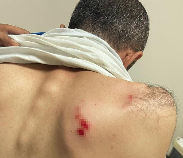 Siirt’te enerji şirketi saha ekibine saldırıda 2 personel yaralandı