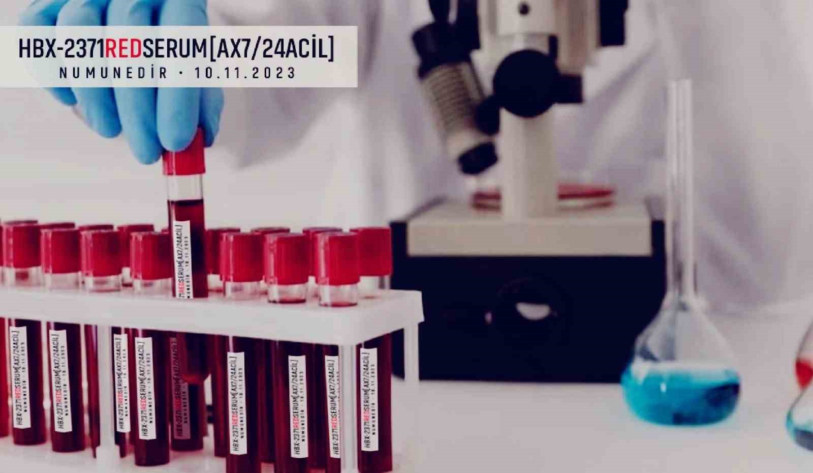 Yılan balıkları göçleri kadar besin değerleri ile de ilgi çekmeye başladı
