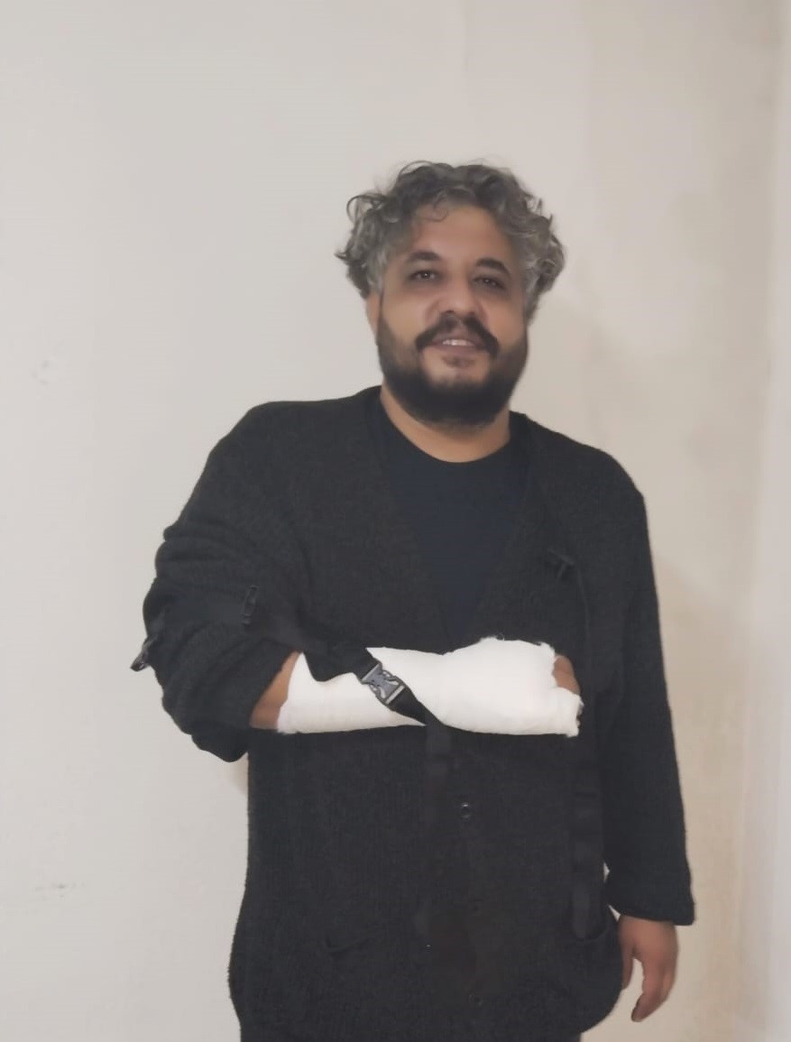 &ldquo;Hoş Geldin Amerika&rdquo;da talihsiz kaza
