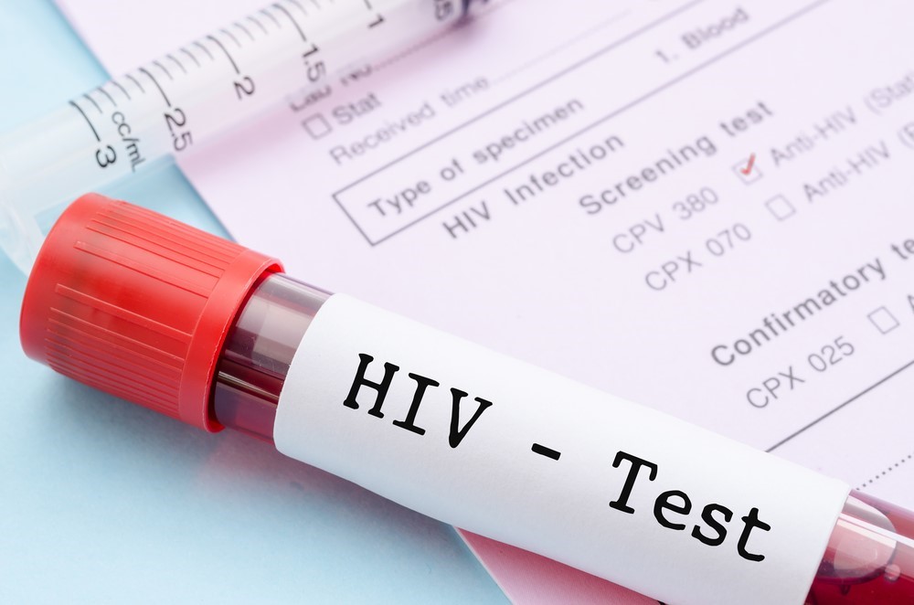 Erkek sünneti, HIV enfeksiyonuna karşı koruyor
