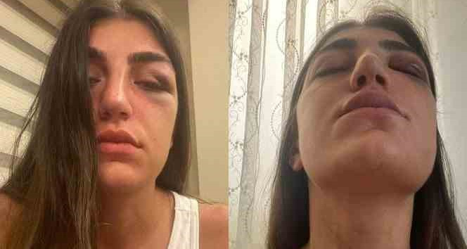 Manken Gizem Akbaş’ın darp edilmesine ilişkin davada sanığa 1 yıl hapis talebi