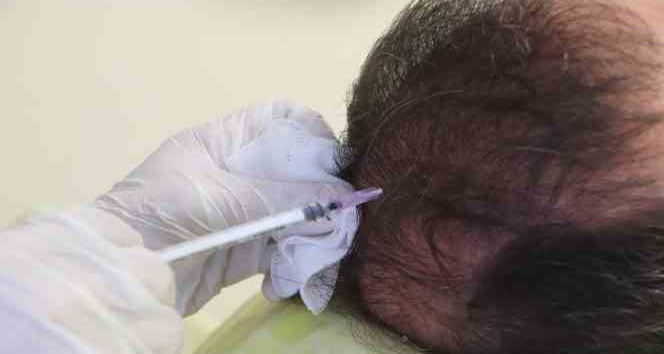 Cildiye profesöründen uyarı: “Saçkıran olan bölgeye sarımsak veya jilet sürmeyin”