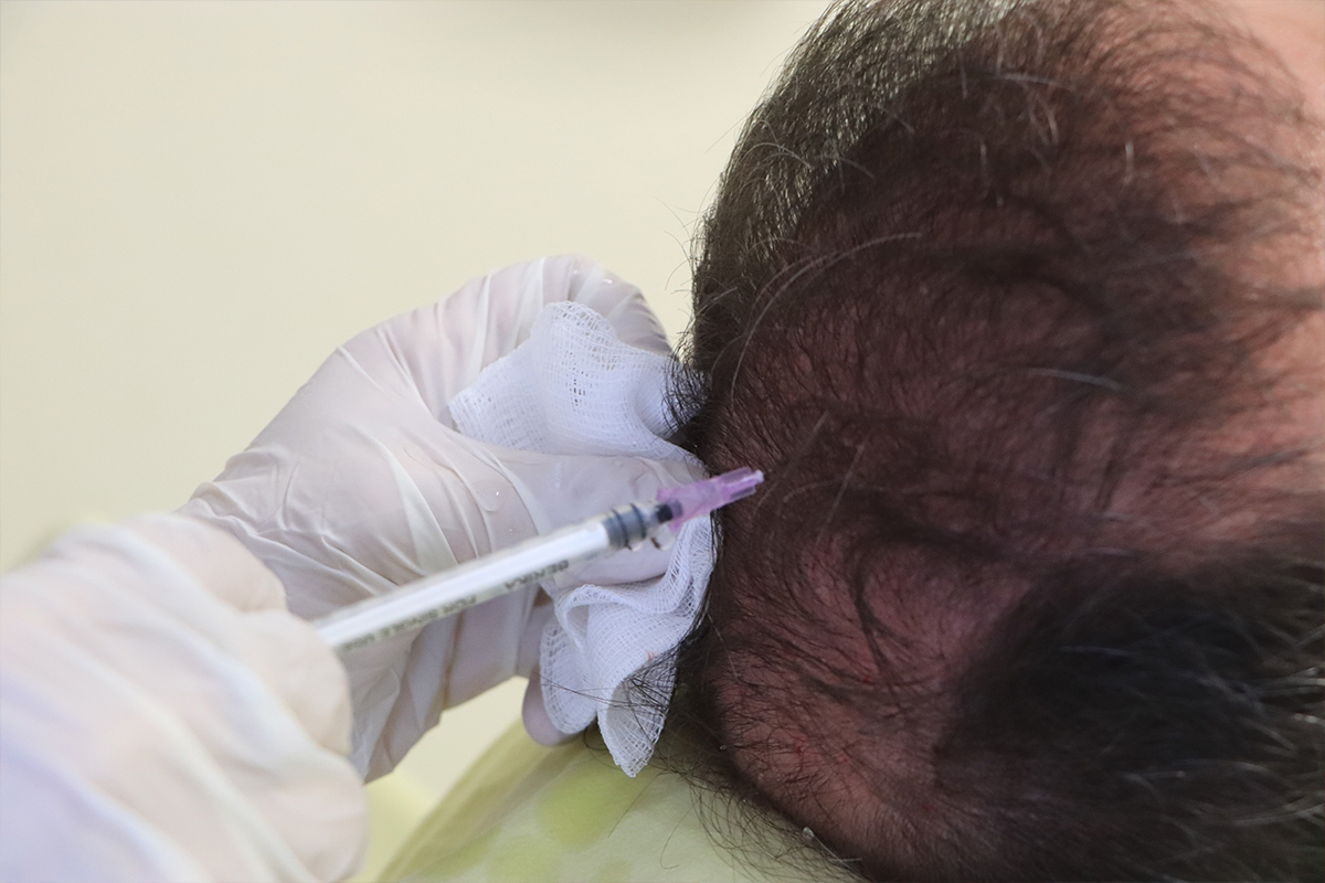 Cildiye profesöründen uyarı: 'Saçkıran olan bölgeye sarımsak veya jilet sürmeyin'