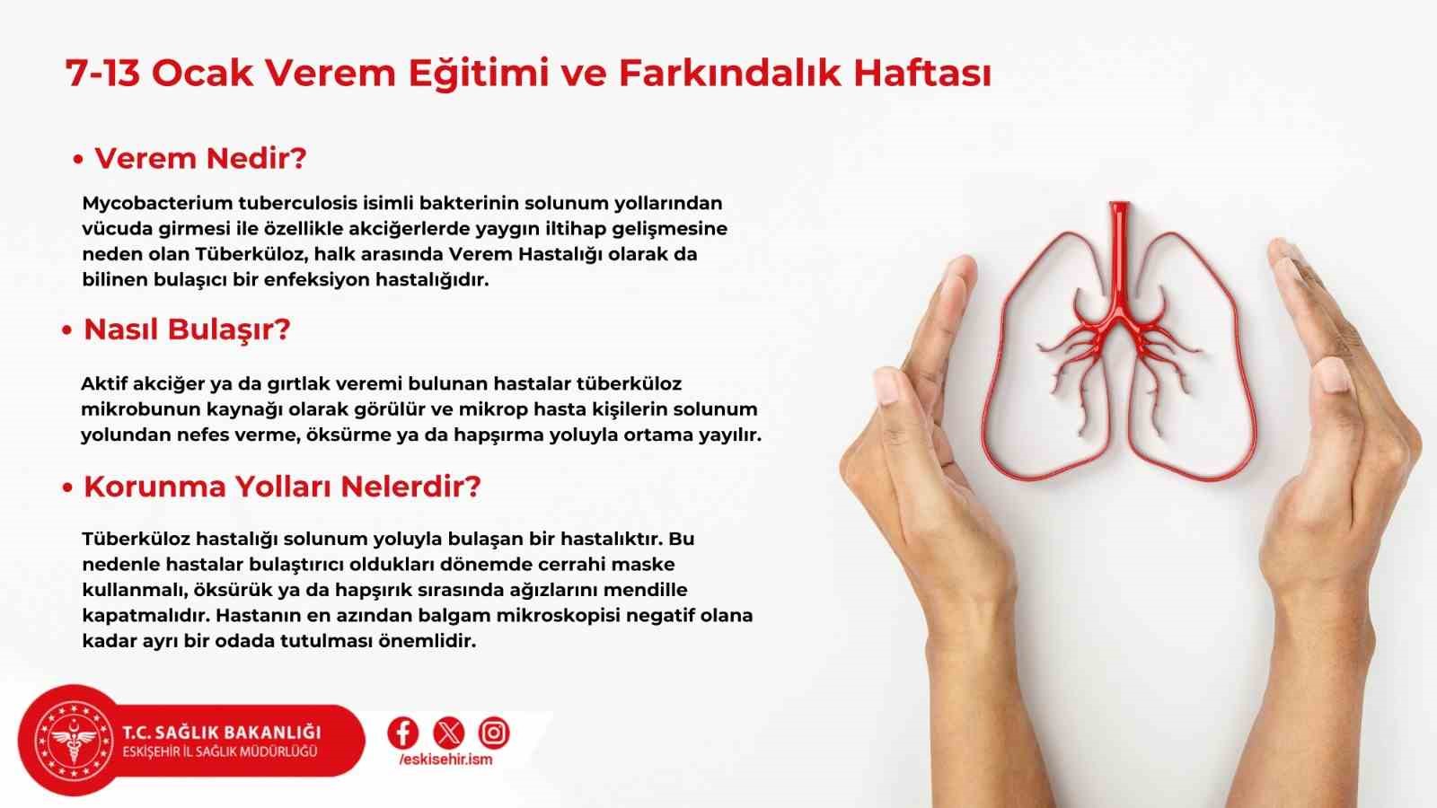 Bildirici ‘Verem Haftası’ sebebiyle basın açıklaması yaptı
