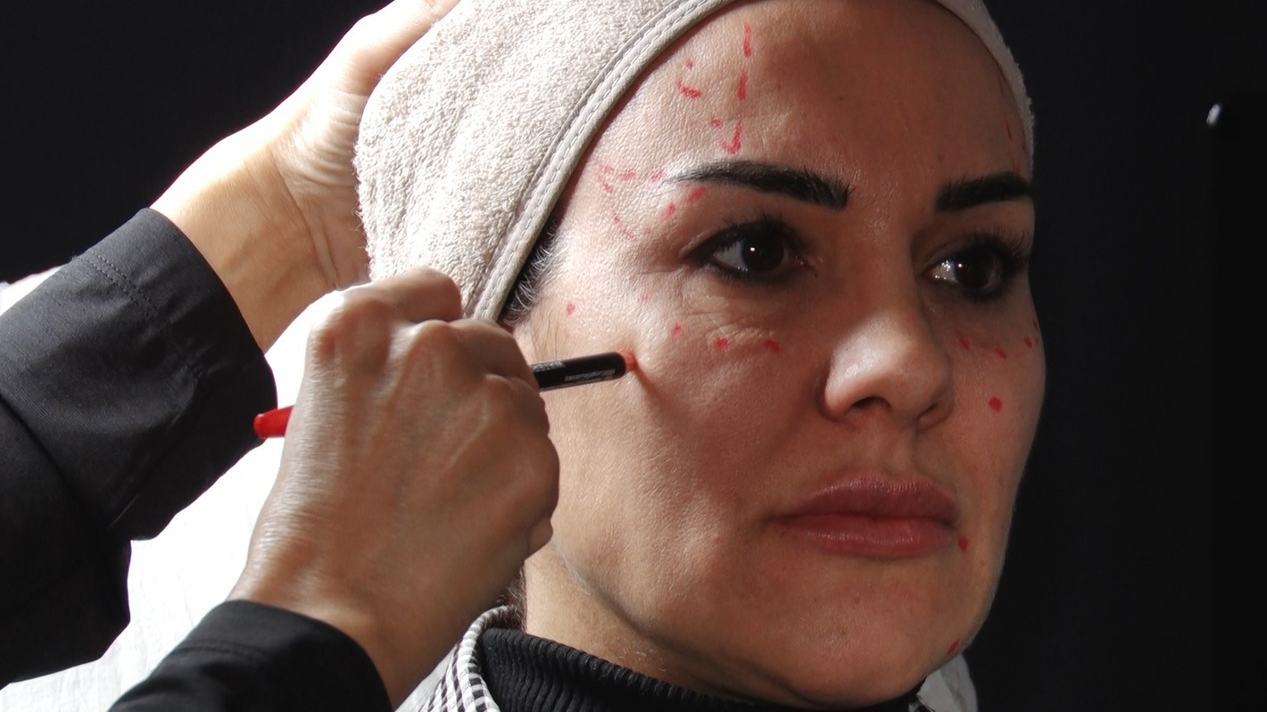 Dermatoloji uzmanından uyarı: “Ruhsatsız ilaçlar vücutta alerjik reaksiyonlara ve ölümlere neden oluyor”
