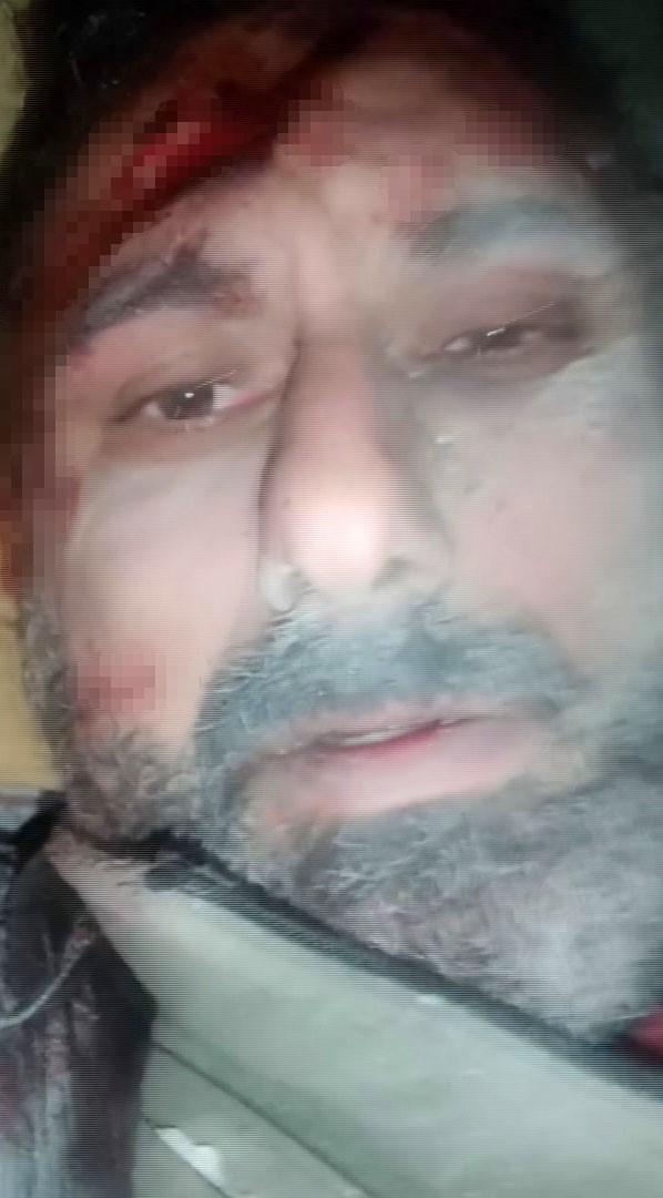 Enkaz altında cep telefonuyla videosunu çekmişti: “Mezardan da dar bir yerde 4 gün kaldım”
