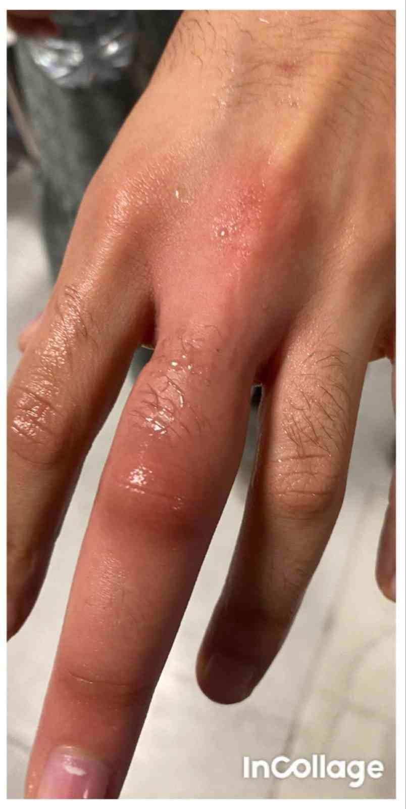 Muğla İtfaiyesinden hastanede &lsquo;Y&uuml;z&uuml;k&rsquo; operasyonu
