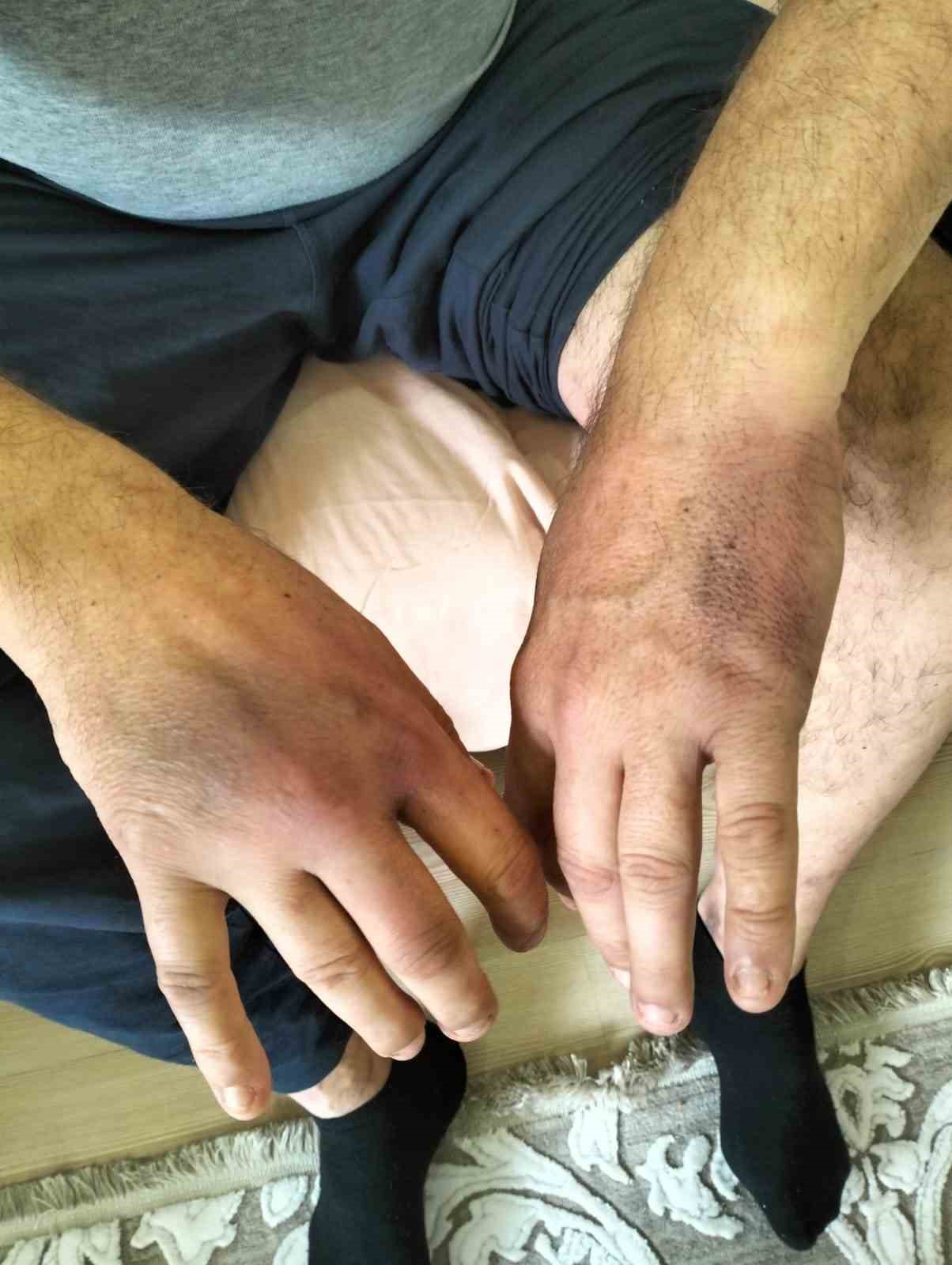 Erdek Belediyesi’ni eleştirdi, hastanelik edilene kadar dövüldü