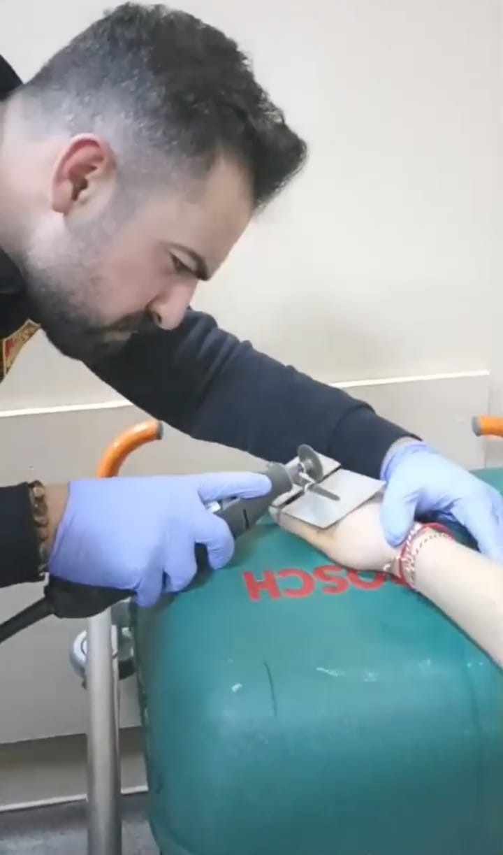 Parmağına sıkışan y&uuml;z&uuml;ğ&uuml; itfaiye &ccedil;ıkardı
