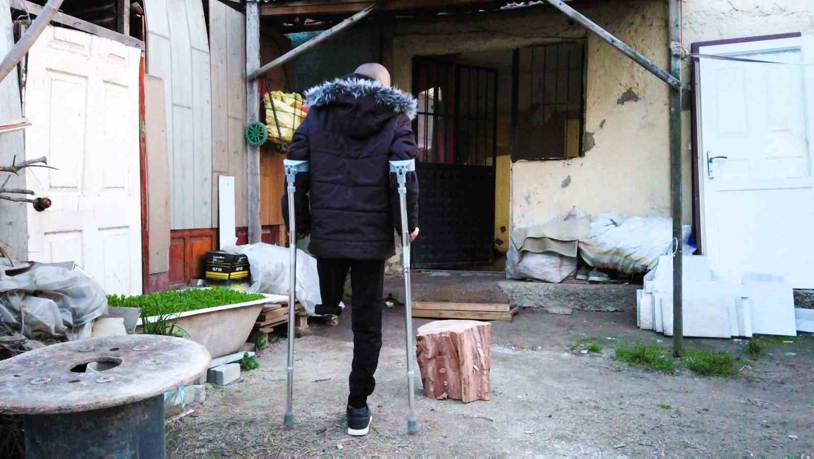 Bir bacağı kesilen İbrahim tedavi olabilmek i&ccedil;in saatlerce yol gidiyor
