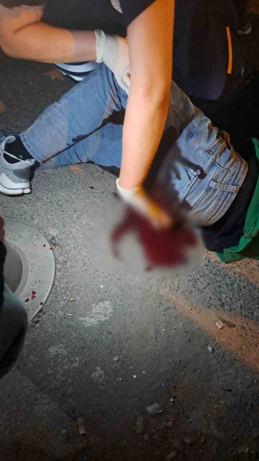 Üsküdar’da saldırıya uğrayan motokurye 5 yerinden bıçaklandı

