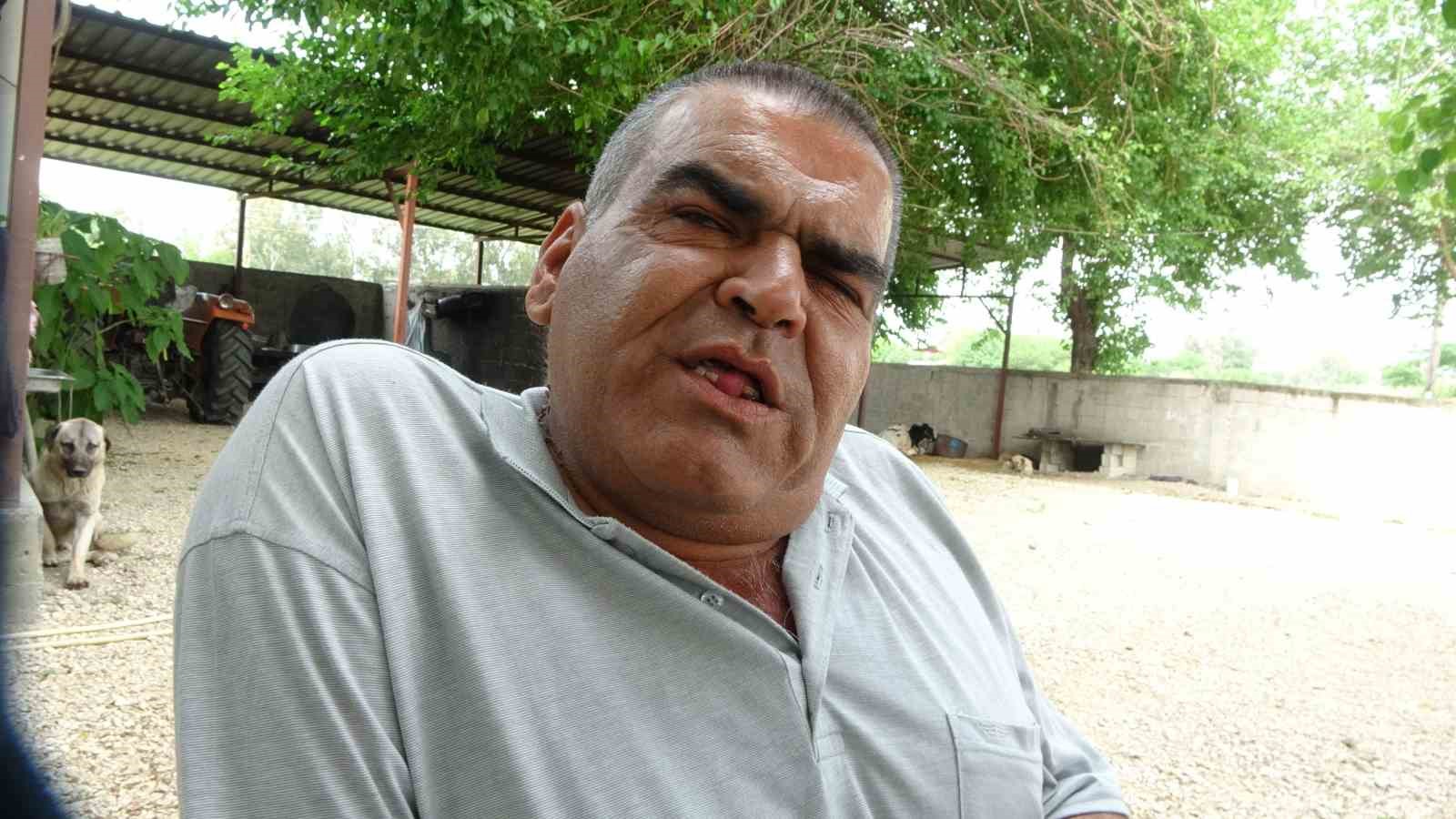 Yaşlı kadını k&ouml;peklerin par&ccedil;aladığı k&ouml;yde vatandaşlar, k&ouml;peklerin toplanmasını istiyor
