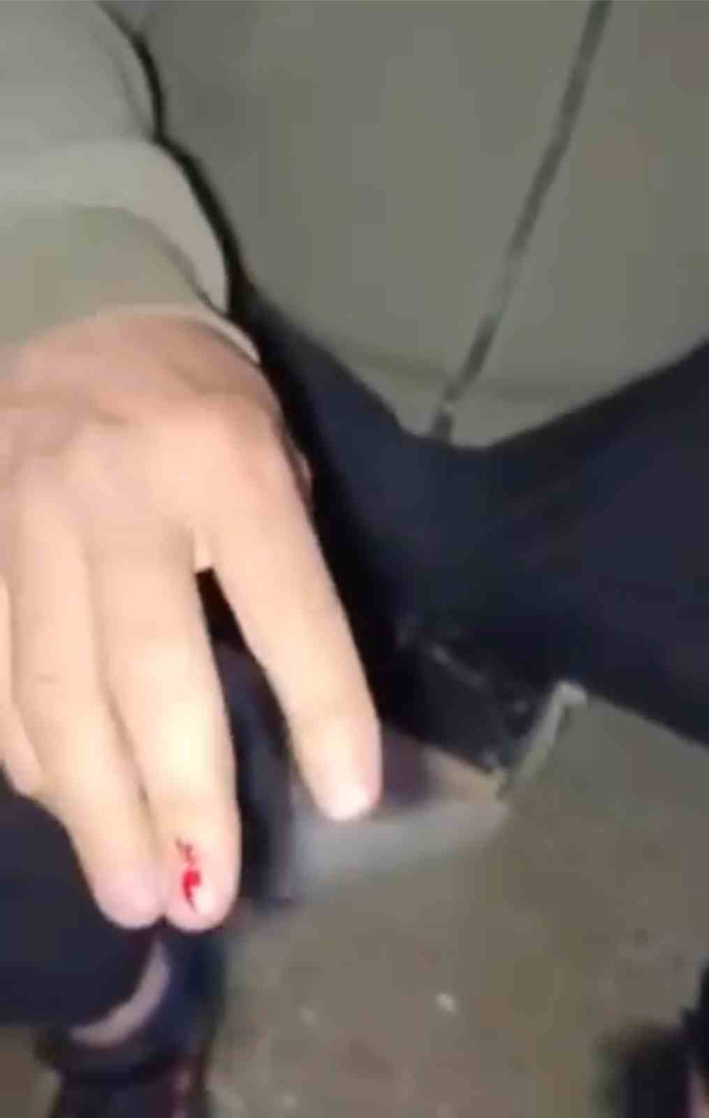 Bursa&rsquo;da a&ccedil; kalan tilki vatandaşın elini ısırdı, hastanede kuduz aşısı oldu
