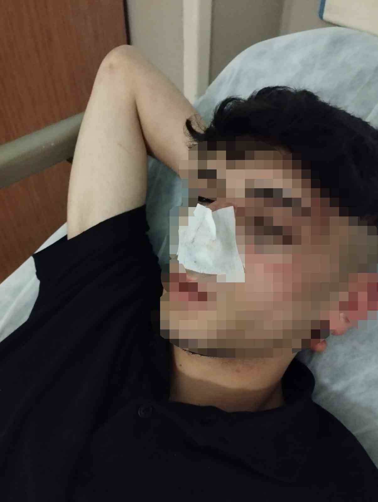 Sultangazi&rsquo;de 17 yaşındaki gen&ccedil; fenomen husumetlileri tarafından b&ouml;yle darbedildi
