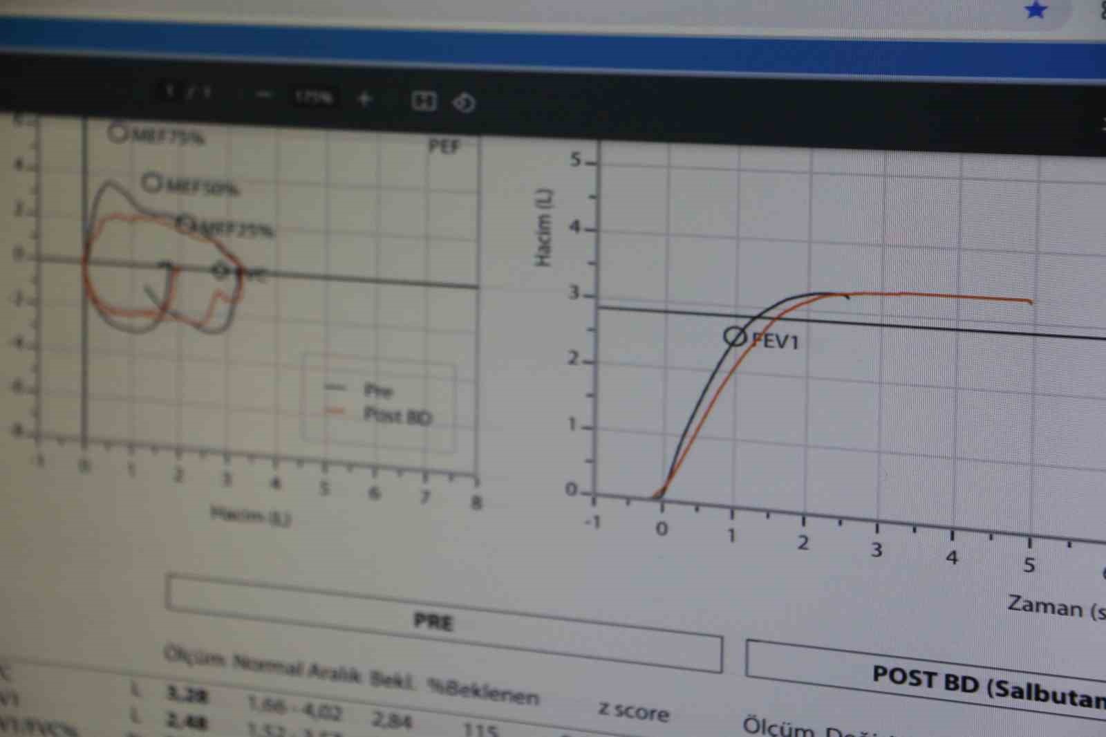 Diyarbakır&rsquo;da Fleksible Bronkoskopi işlemiyle &ccedil;ocukların solunum sistemi kontrol ediliyor
