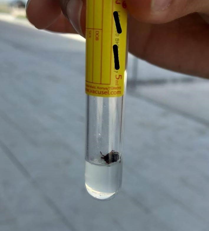 Konya&rsquo;da bir mahallede 3 kişiye kene yapıştı
