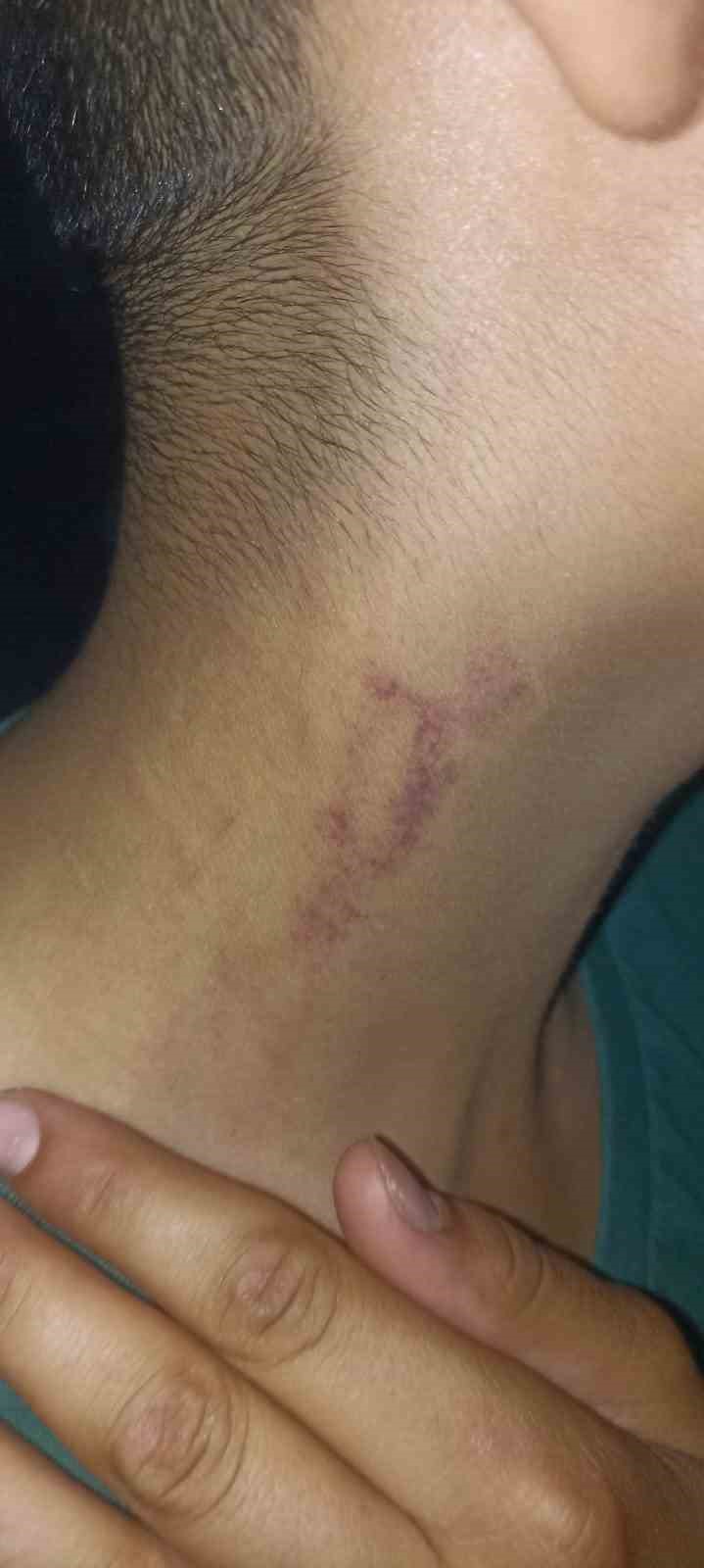 Alanya’da otelin lojmanında futbol oynadıkları için iki çocuğun darp edildiği iddiası