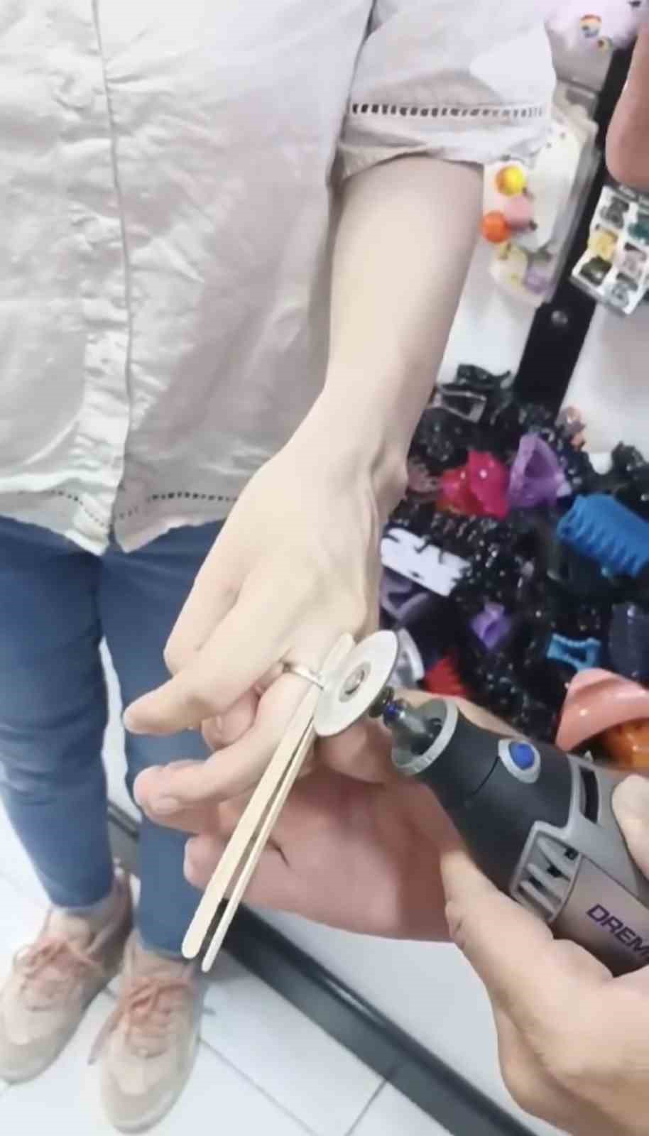 Parmağında sıkışan y&uuml;z&uuml;k kesilerek &ccedil;ıkarıldı
