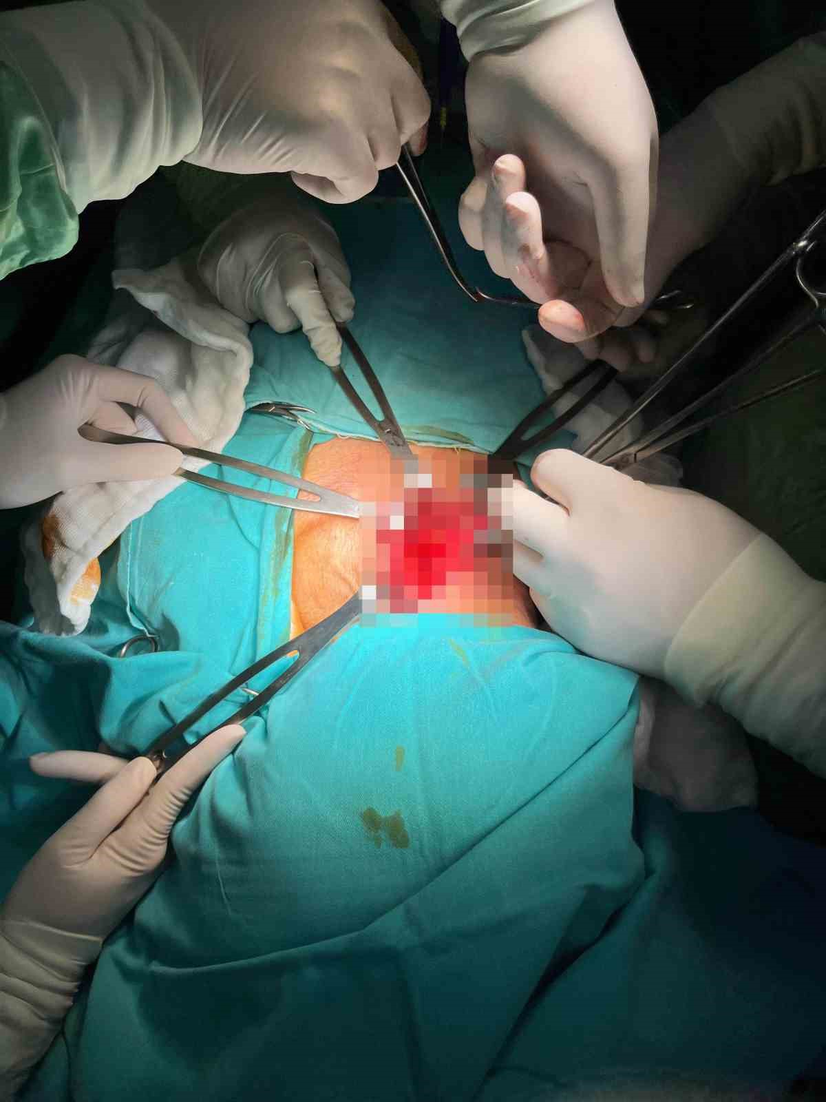 6 ay sonra ilk kez su i&ccedil;ebildi: "İ&ccedil;tiğim su zemzem gibi geldi"
