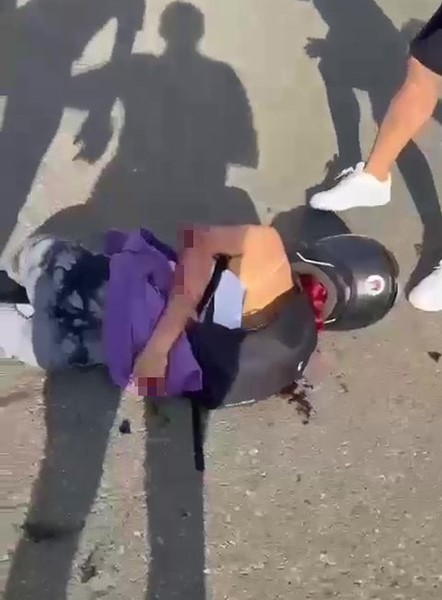 S&uuml;rat motoruyla hız faciayla bitti, metrelerce s&uuml;r&uuml;klenen kızın kolu kopma noktasına geldi
