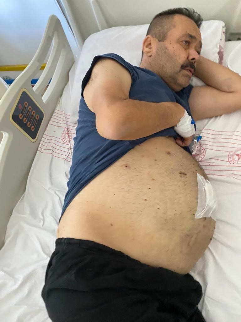 Şeker hastalığı nedeniyle 2 yıl &ouml;nce mide k&uuml;&ccedil;&uuml;ltme ameliyatı olan hasta hayatını kaybetti
