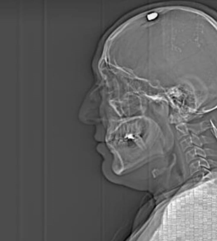 Kuzeninin adresini vermediği için başından vuruldu, kurtulmak için ölü taklidi yaptı