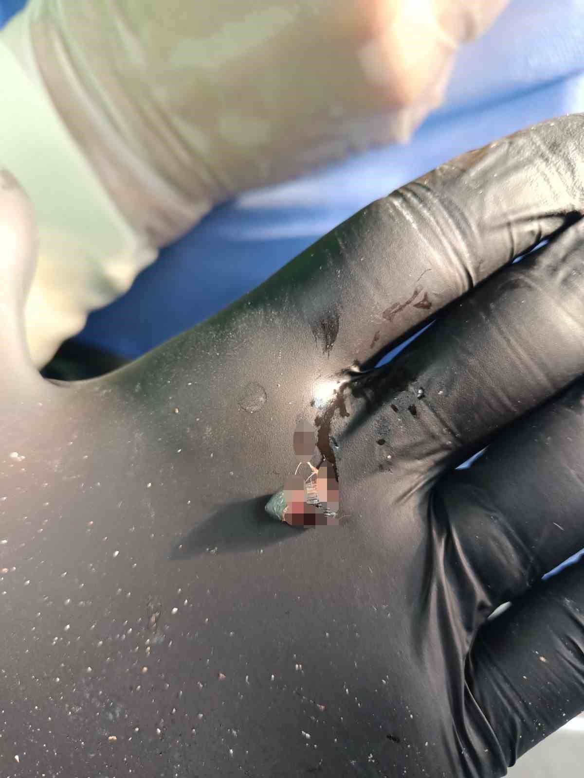 Araba &ccedil;arptı sandı, t&uuml;fekle vurulduğunu &ouml;ğrendi
