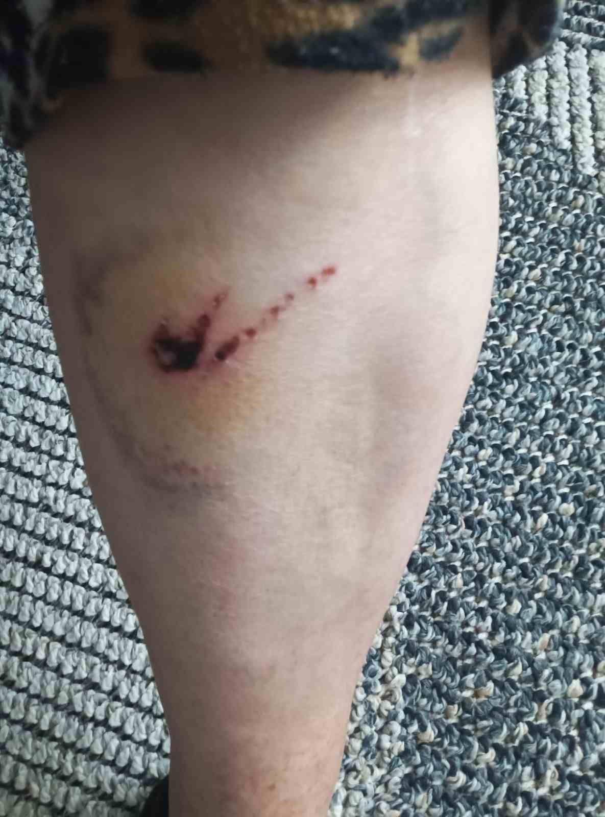 K&uuml;tahya&rsquo;da sokak k&ouml;peklerinin saldırısına uğrayan kadın hastanelik oldu
