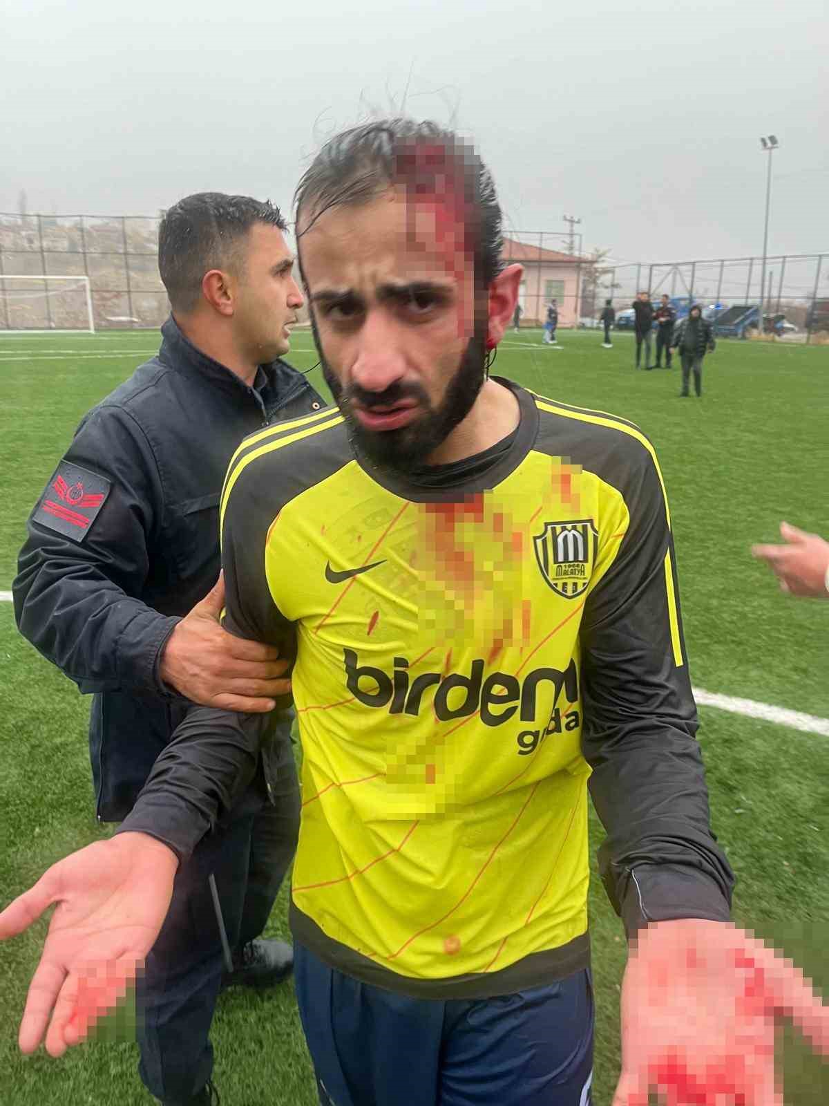 (D&Uuml;ZELTME) Amat&ouml;r ma&ccedil;ta saha karıştı, futbolcular taşlı saldırıda yaralandı
