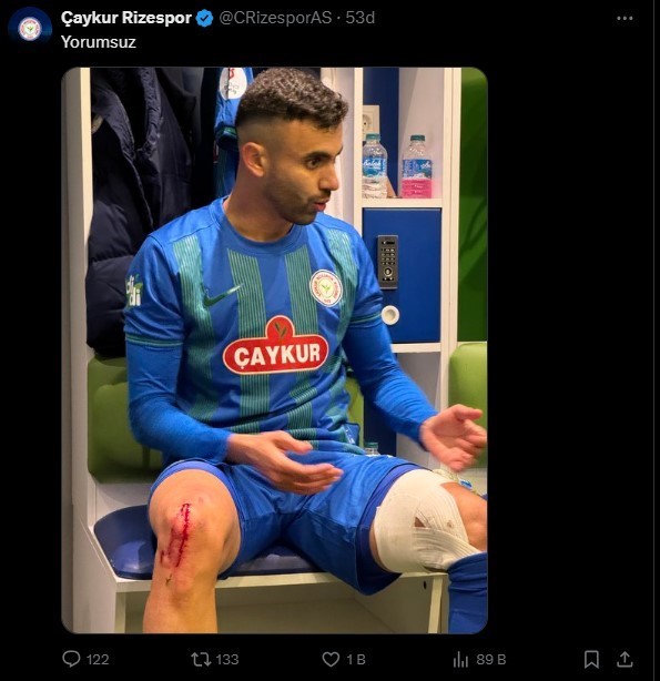 Çaykur Rizespor, Rachid Ghezzal’ın darbe alan ayağının fotoğrafını paylaştı