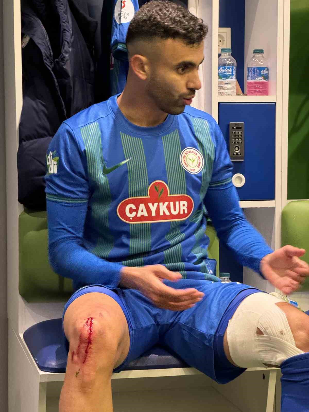 Çaykur Rizespor, Rachid Ghezzal’ın darbe alan ayağının fotoğrafını paylaştı
